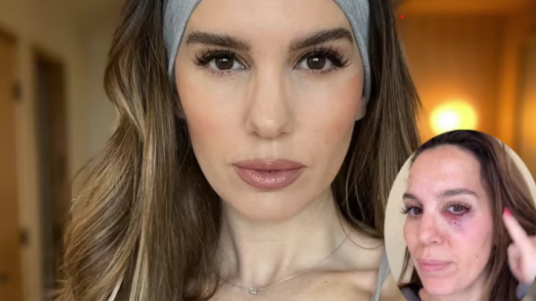 Christy Carlson Romano estuvo a punto de perder un ojo tras un disparo en el rostro